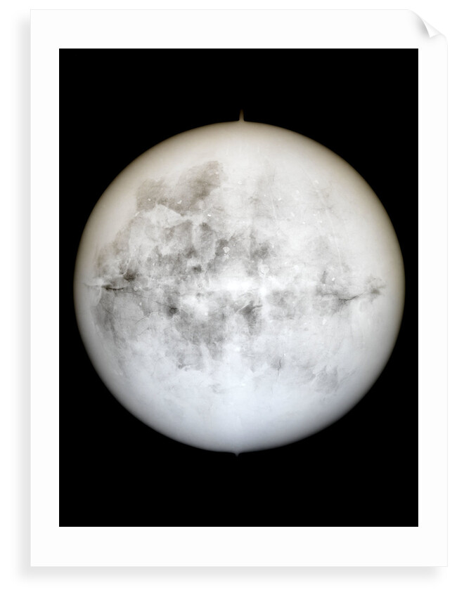 Globe x-ray by Hyacinthe Langlois