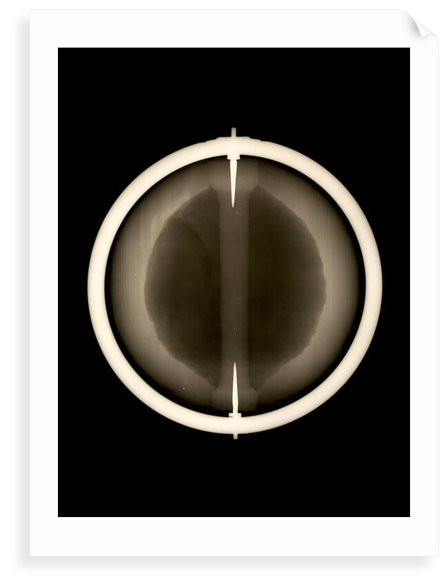 Globe x-ray by Joannes Oterschaden