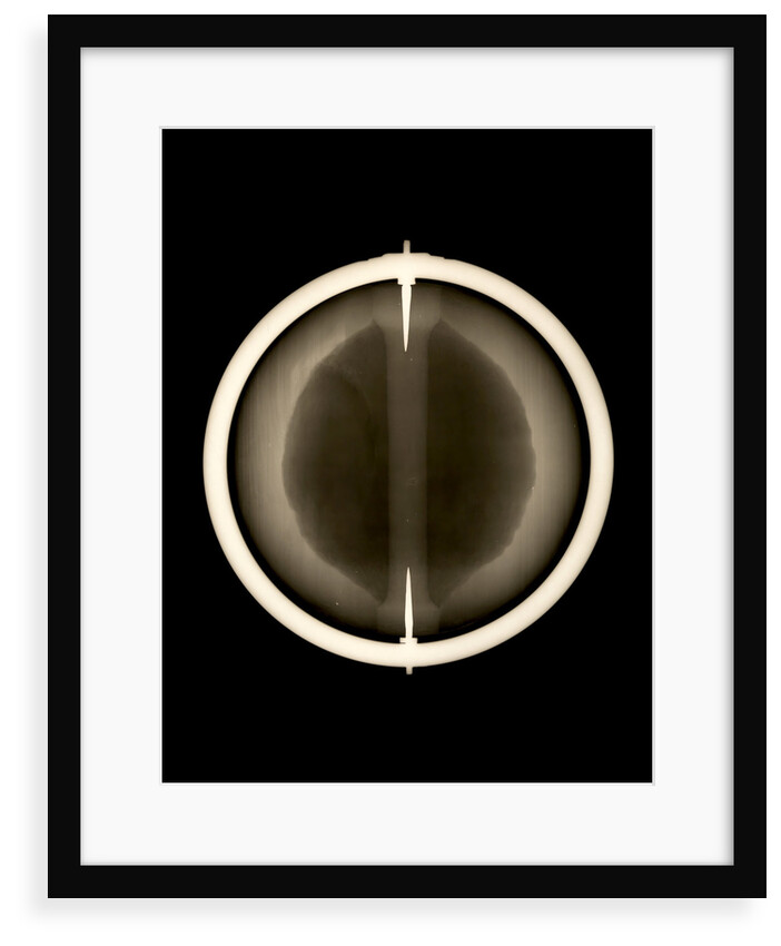 Globe x-ray by Joannes Oterschaden