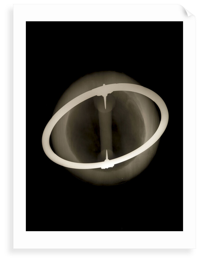 Globe x-ray by Joannes Oterschaden