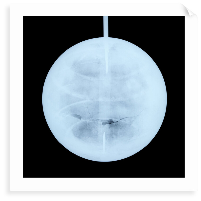 Globe x-ray by Peter Anich
