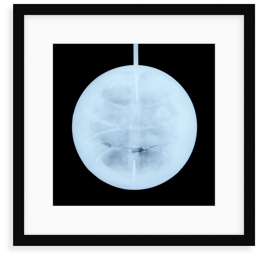 Globe x-ray by Peter Anich