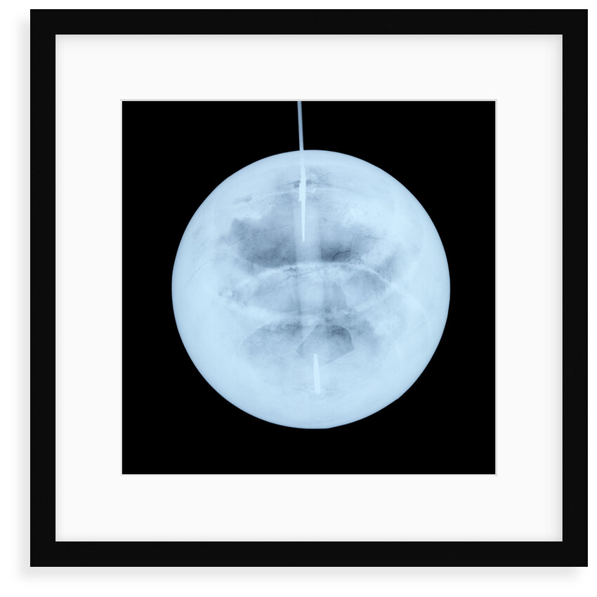 Globe x-ray by Peter Anich