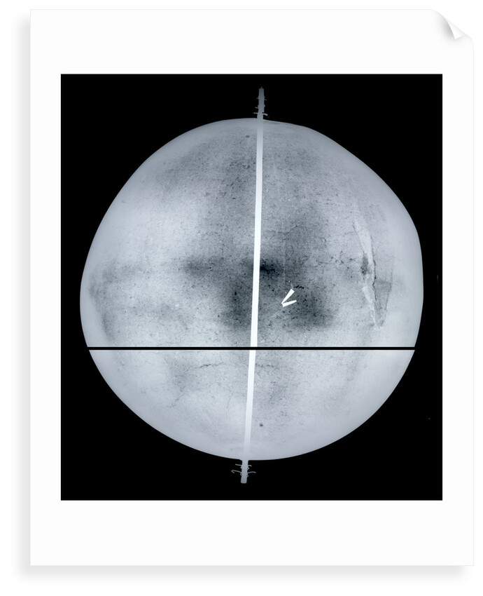 Globe x-ray by Gemma Frisius