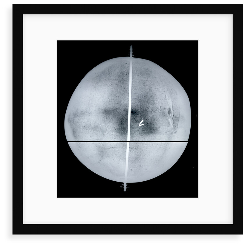Globe x-ray by Gemma Frisius