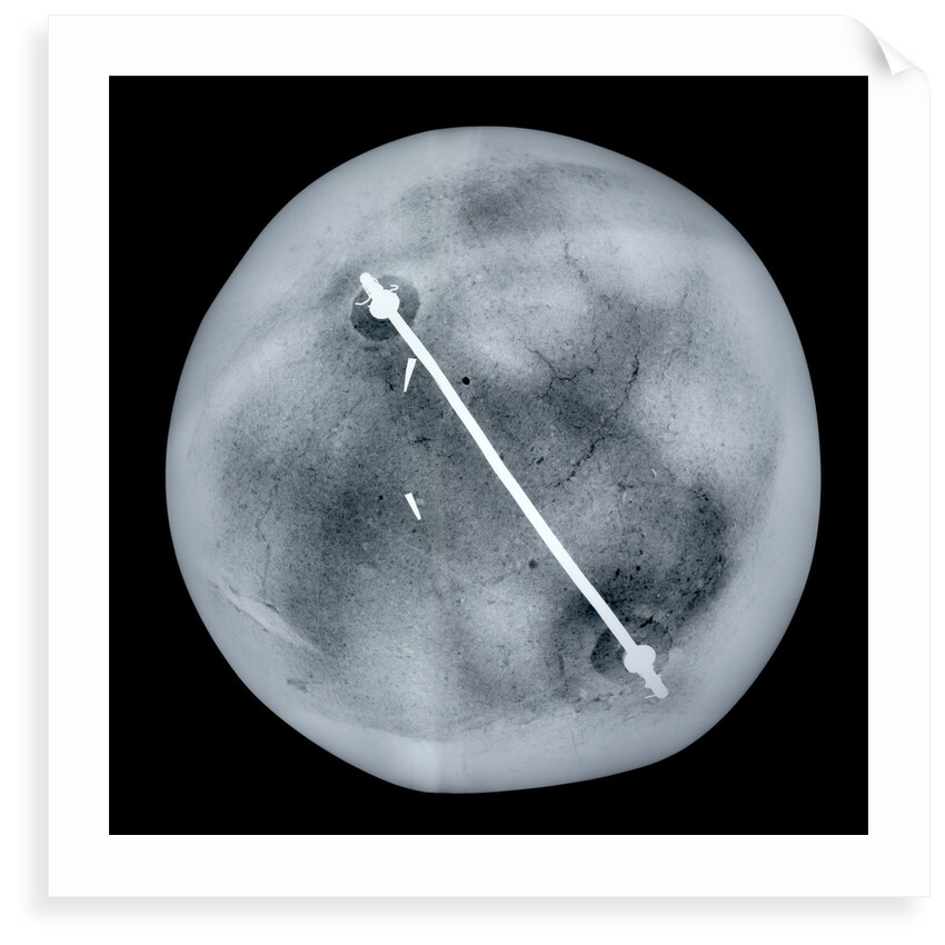 Globe x-ray by Gemma Frisius