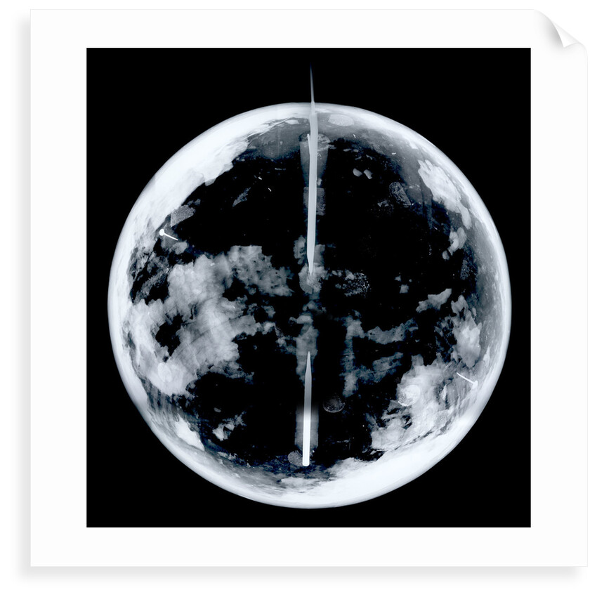 Globe x-ray by unknown