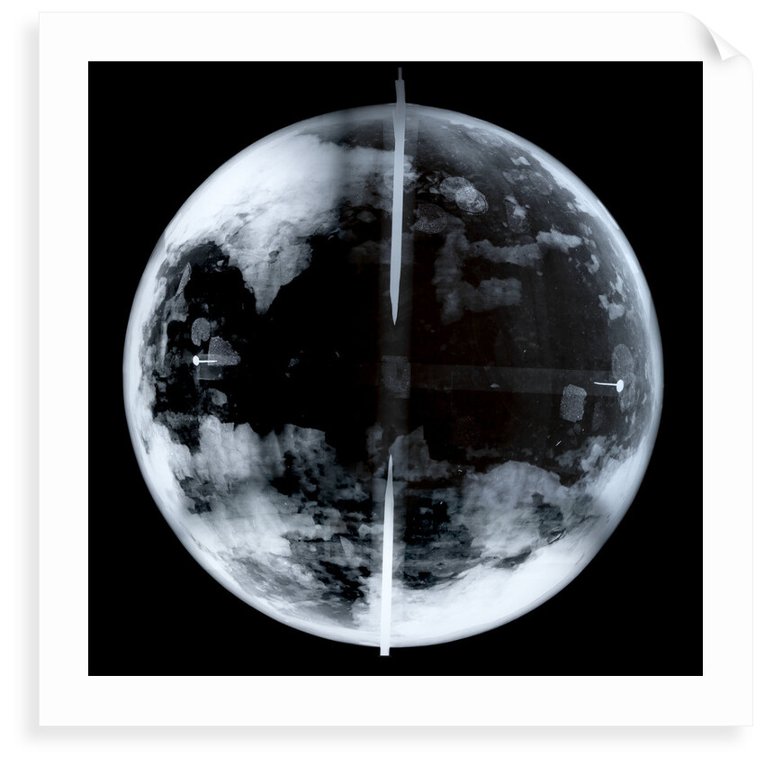 Globe x-ray by unknown
