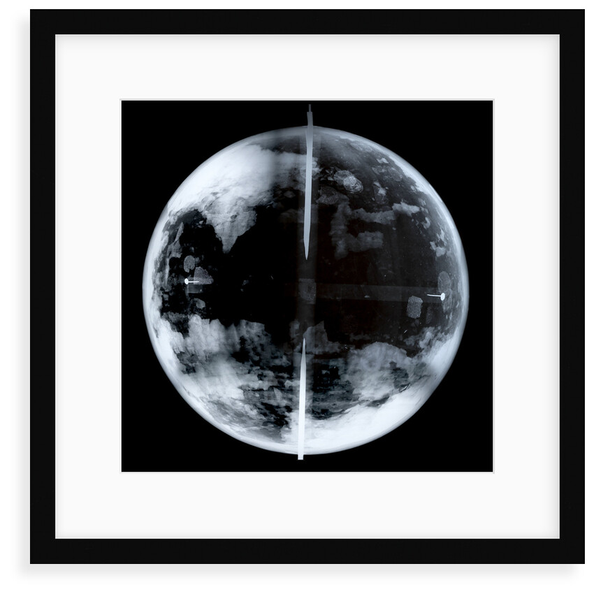 Globe x-ray by unknown