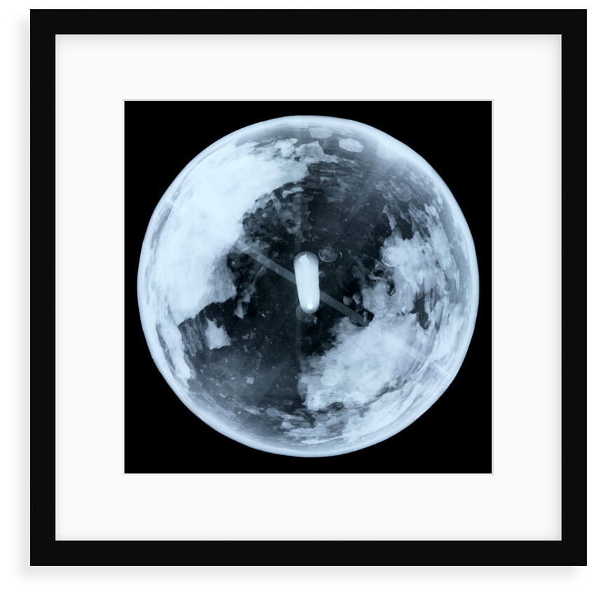 Globe x-ray by unknown