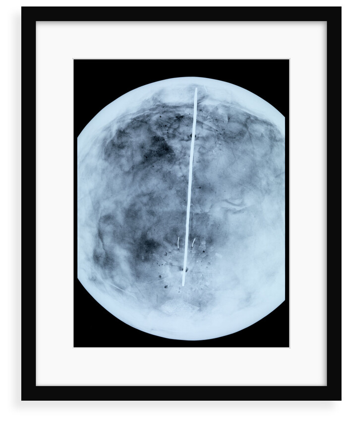 Globe x-ray by Giovanni Maria Cassini
