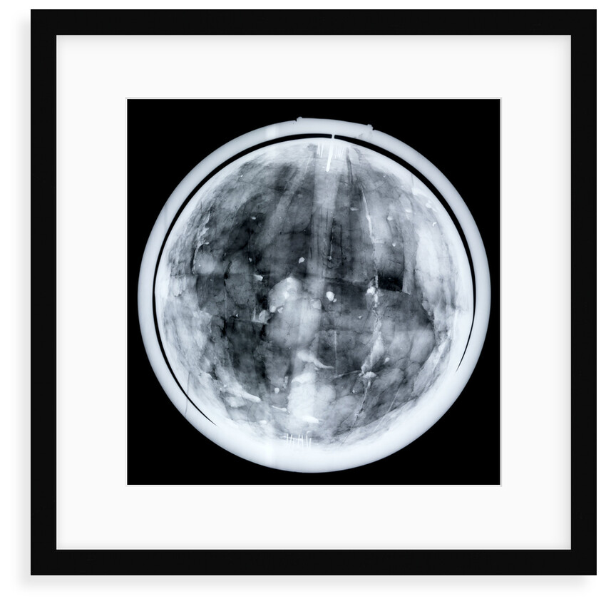 Globe x-ray by Jacques Hardy
