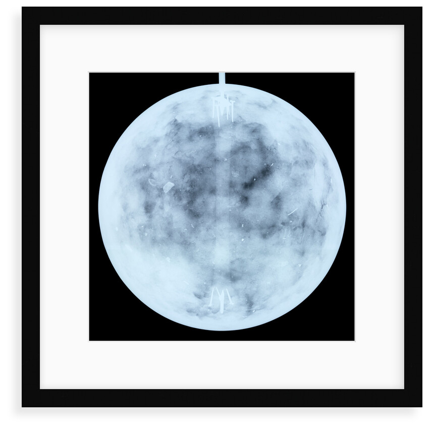 Globe x-ray by Johann Georg Klinger