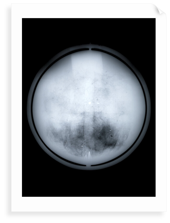 Globe x-ray by Charles Price
