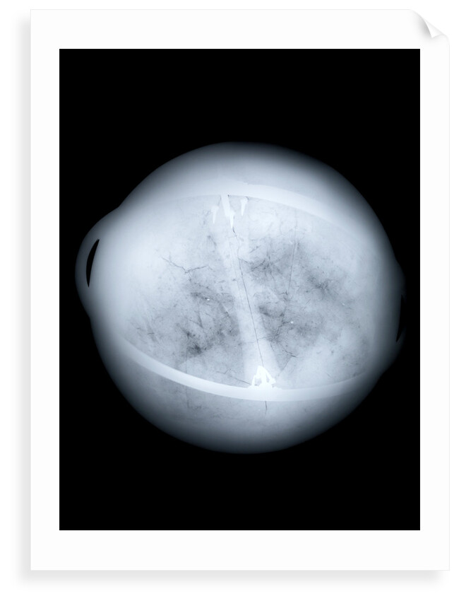 Globe x-ray by Charles Price