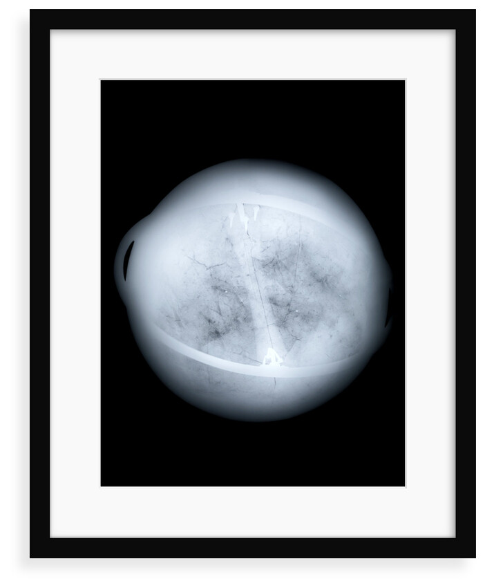 Globe x-ray by Charles Price