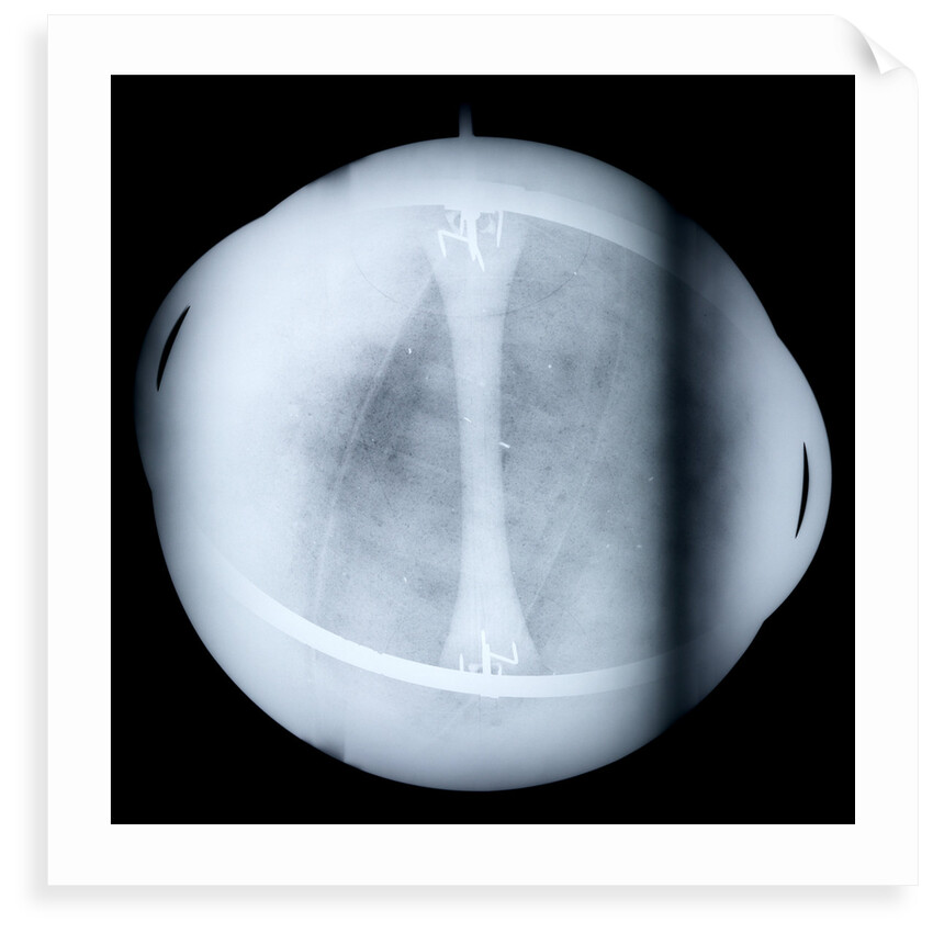 Globe x-ray by Jacques de La Feuille