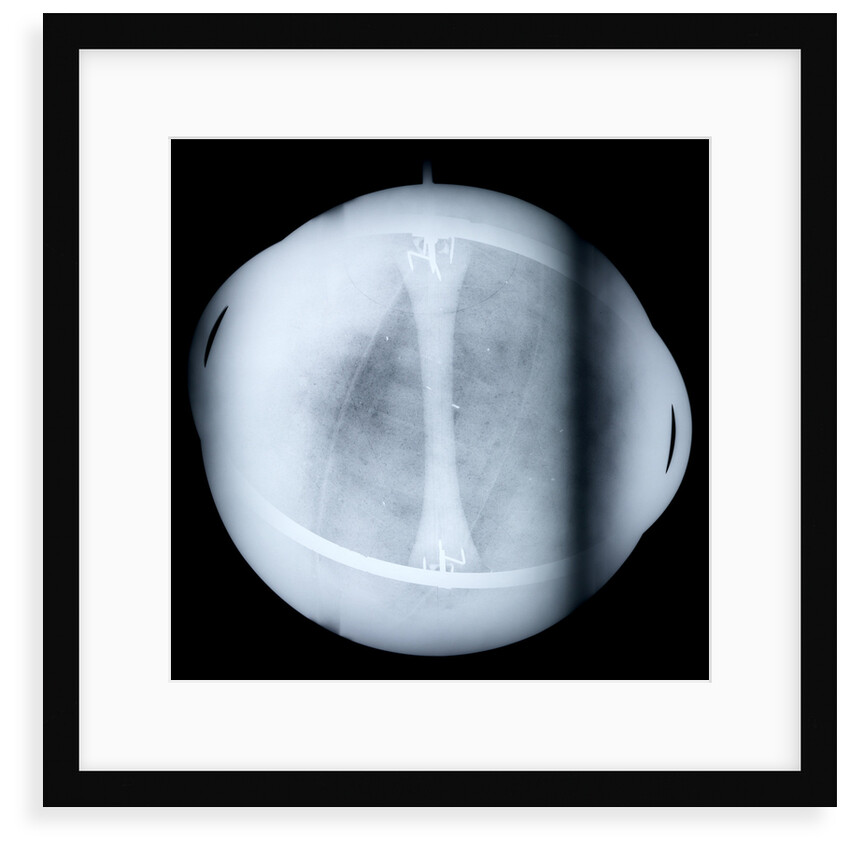 Globe x-ray by Jacques de La Feuille