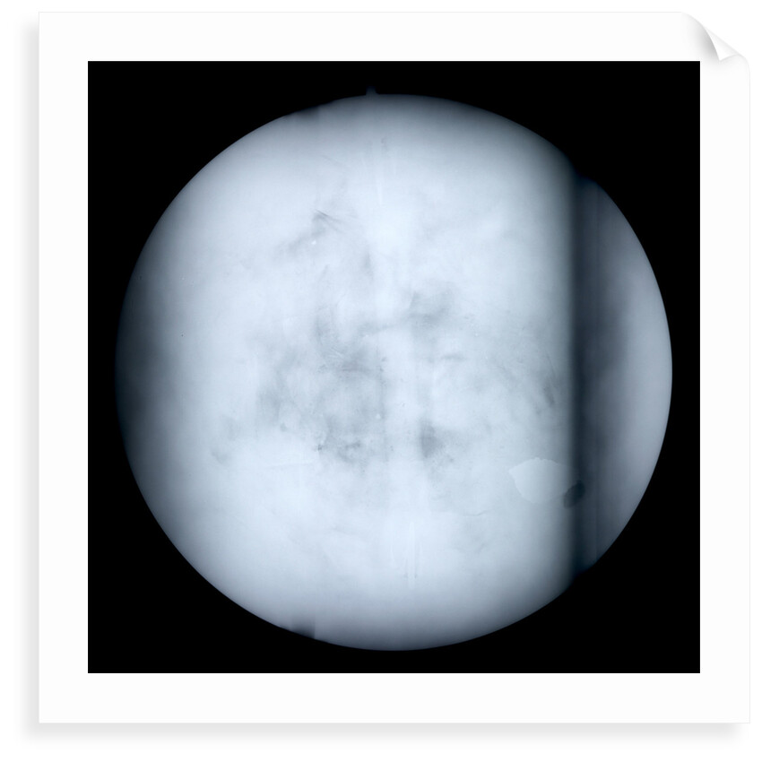 Globe x-ray by Robert Morden
