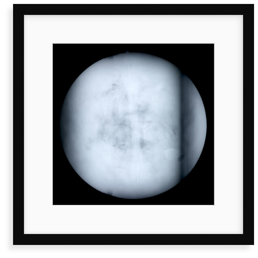 Globe x-ray by Robert Morden