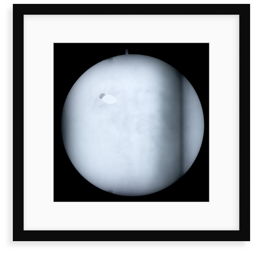 Globe x-ray by Robert Morden
