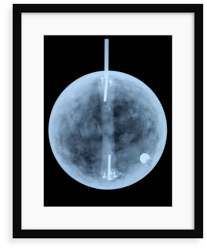 Globe x-ray by William Bardin