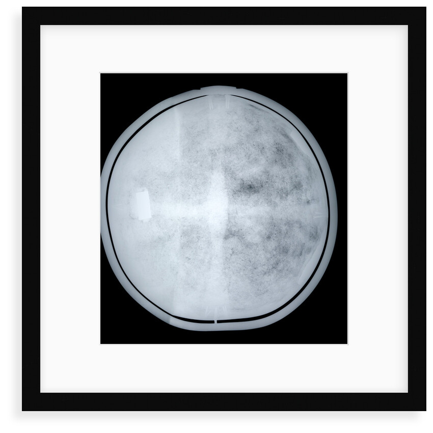 Globe x-ray by Jacob Aertsz Colom