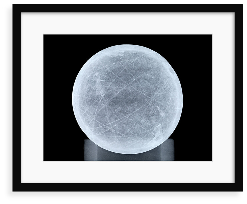 Globe x-ray by unknown