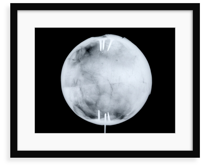 Globe x-ray by Herman Moll