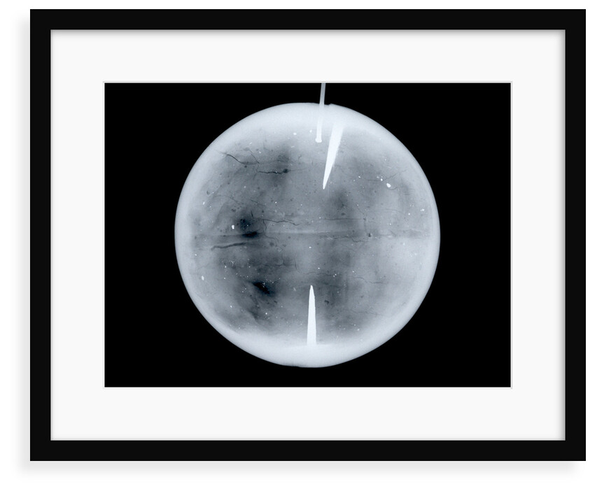 Globe x-ray by Dudley Adams