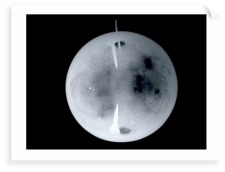 Globe x-ray by Dudley Adams