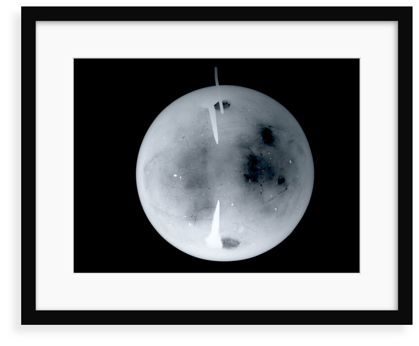 Globe x-ray by Dudley Adams