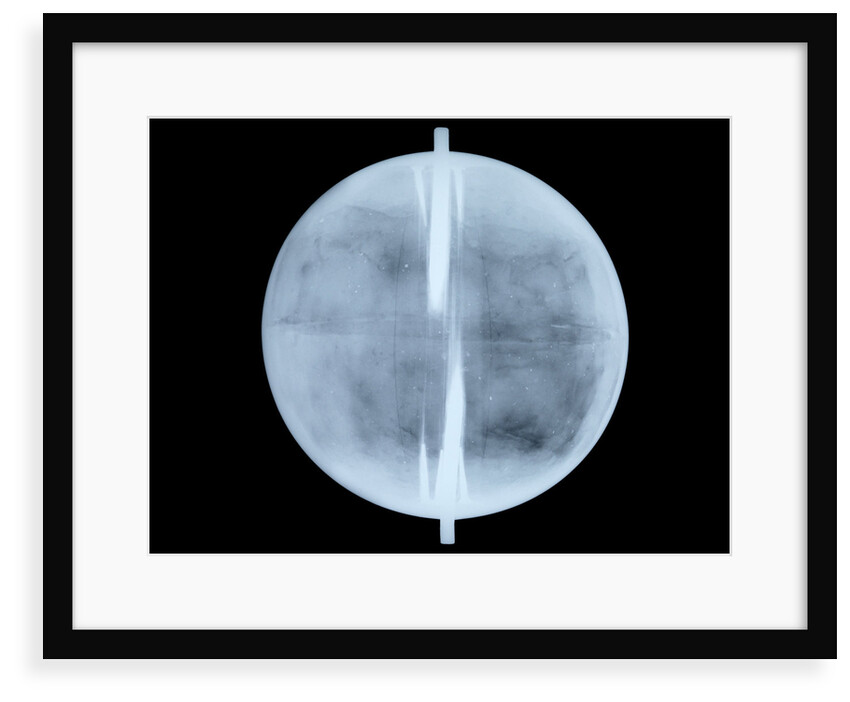 Globe x-ray by Thomas Patrick