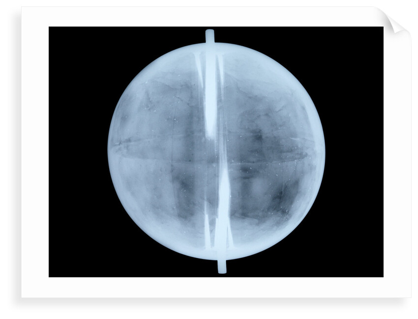 Globe x-ray by Thomas Patrick