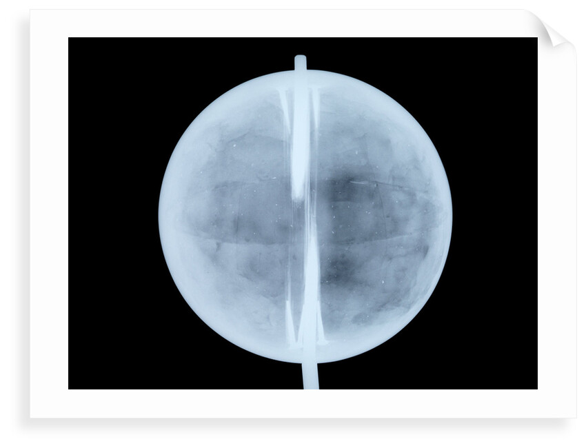 Globe x-ray by Thomas Patrick