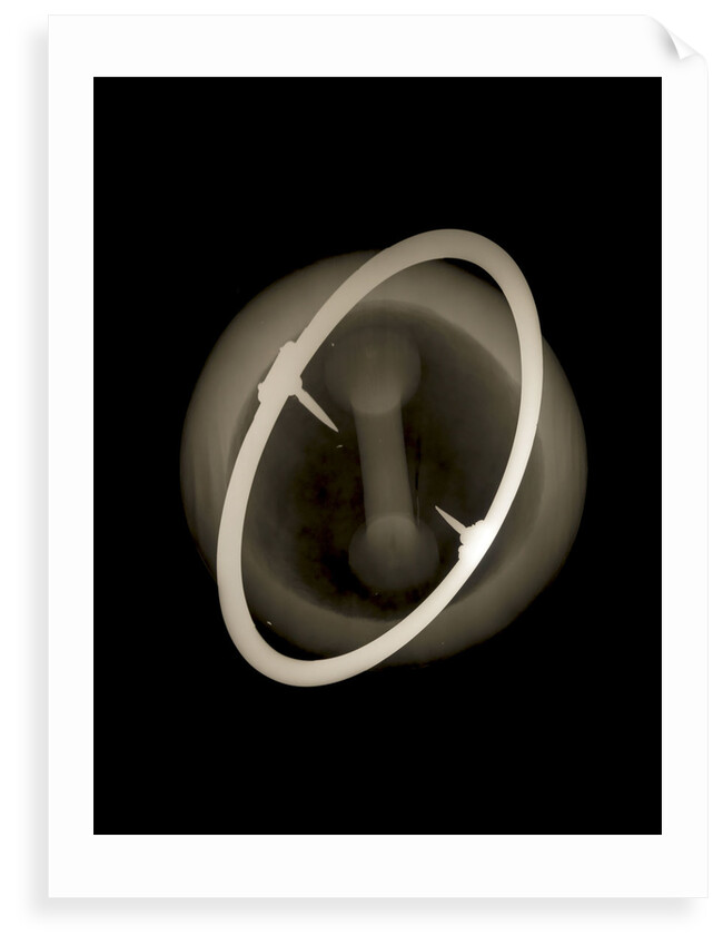 Globe x-ray by Joannes Oterschaden