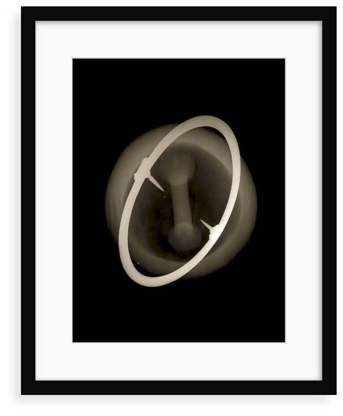 Globe x-ray by Joannes Oterschaden