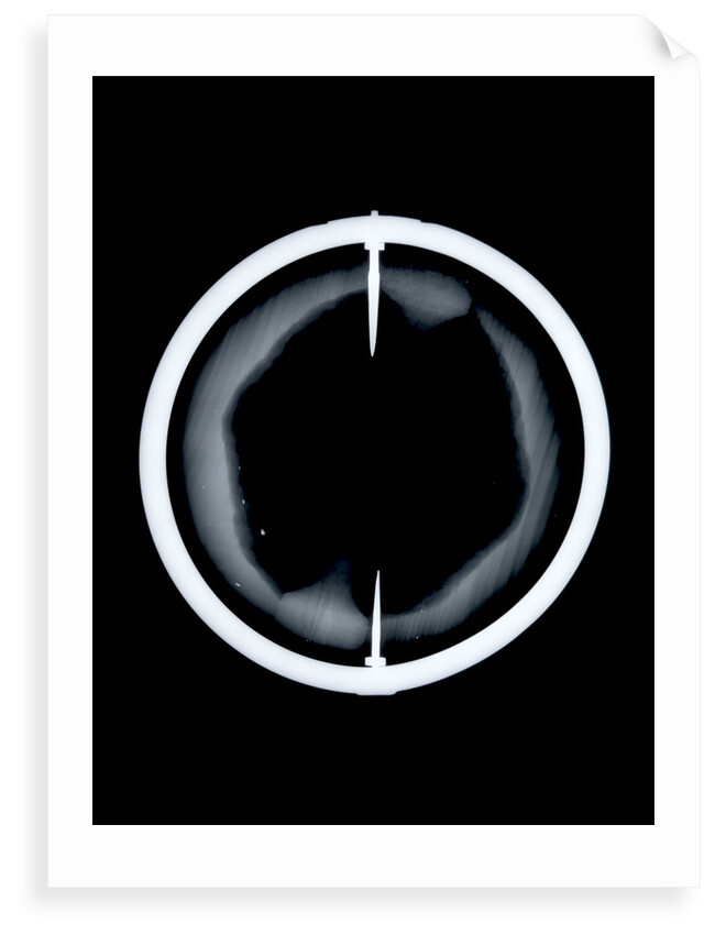 Globe x-ray by Joannes Oterschaden