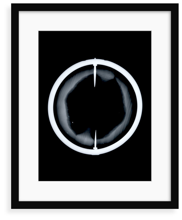 Globe x-ray by Joannes Oterschaden