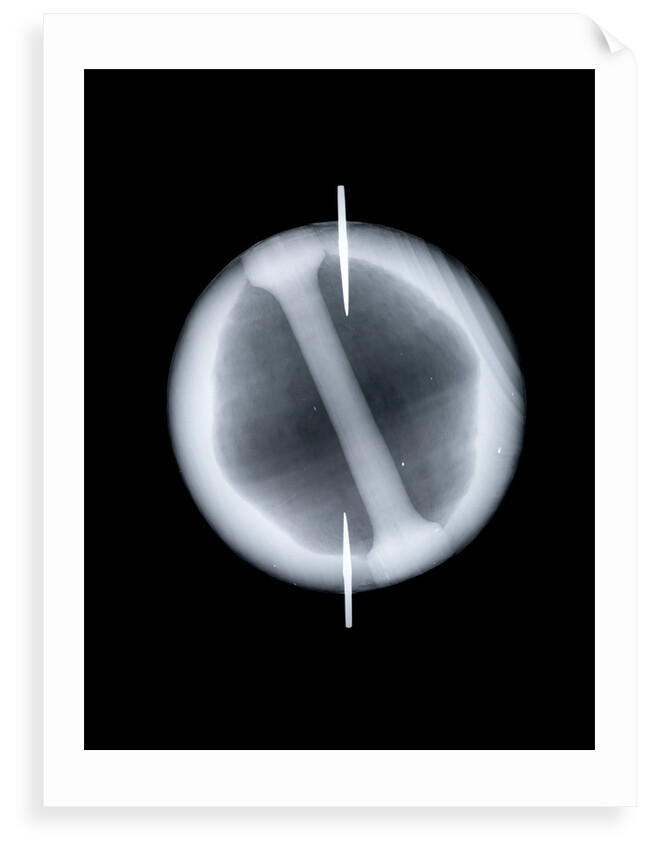 Globe x-ray by Joannes Oterschaden