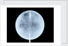 Globe x-ray by John Cary