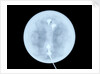 Globe x-ray by West