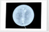 Globe x-ray by West