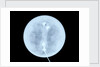 Globe x-ray by West