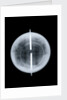 Globe x-ray by West