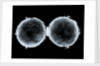 Globe x-ray by West