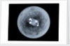 Globe x-ray by Charles Price