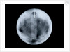 Globe x-ray by George Adams