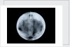 Globe x-ray by George Adams