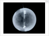 Globe x-ray by William Palmer